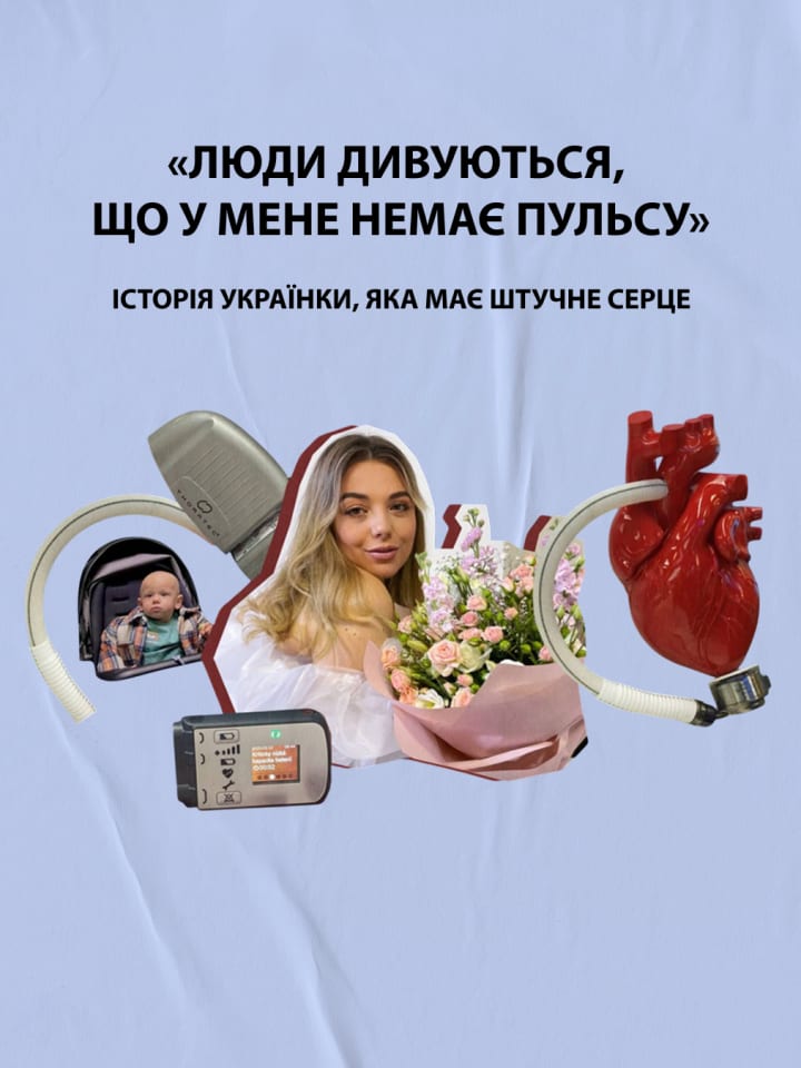 «Люди дивуються, що у мене немає пульсу». Історія українки, яка має штучне серце