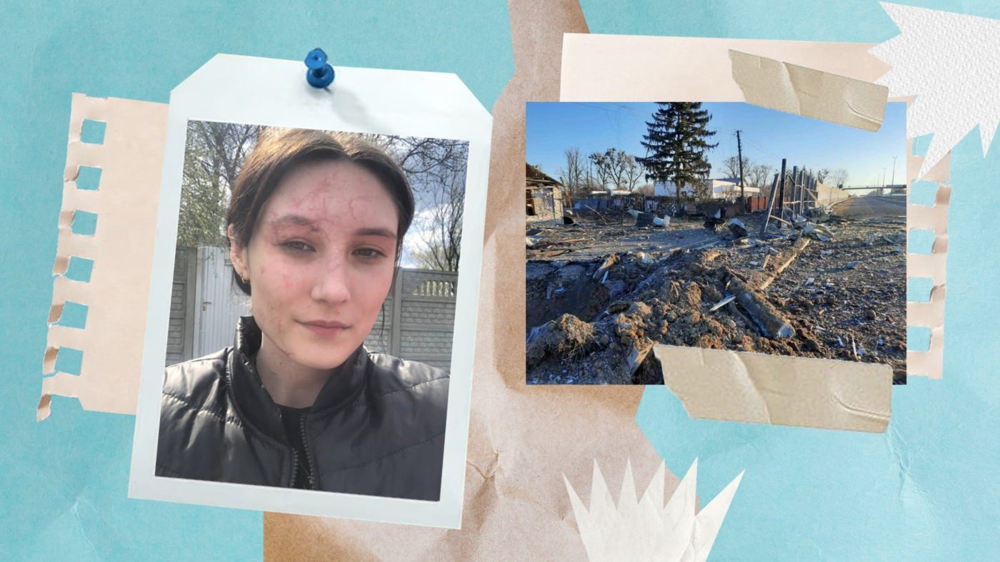 «Я поверну своє обличчя»: чому психологічна реабілітація після травми є важливою та як її отримати