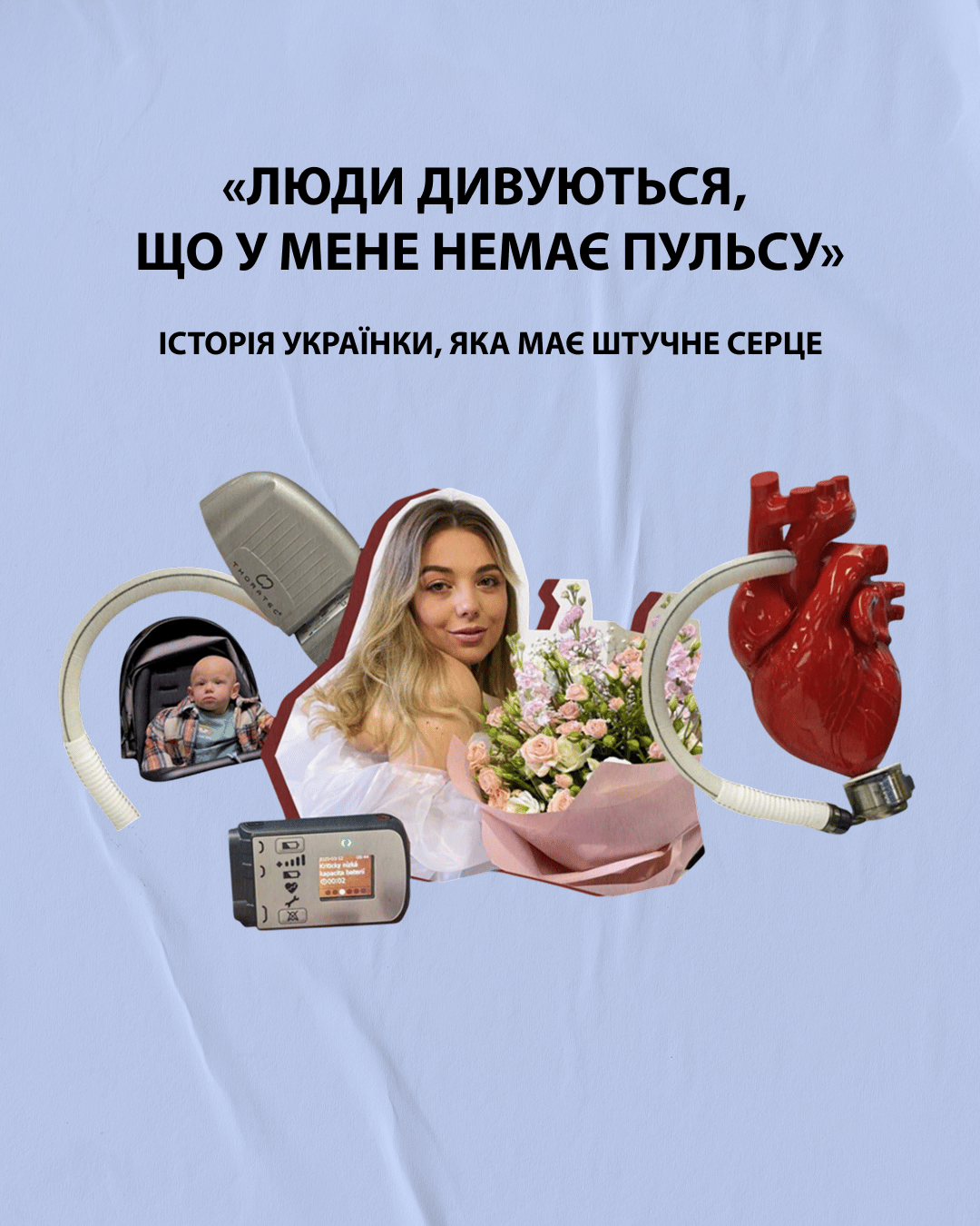 «Люди дивуються, що у мене немає пульсу». Історія українки, яка має штучне серце