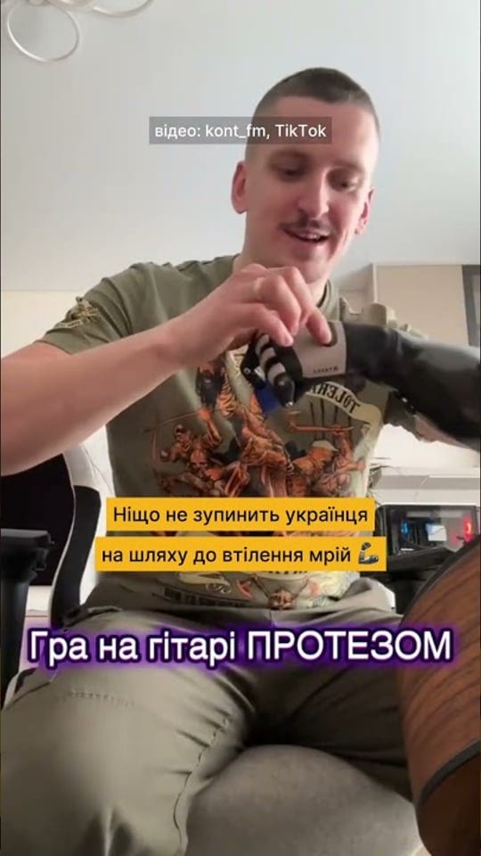Українець грає на гітарі протезом