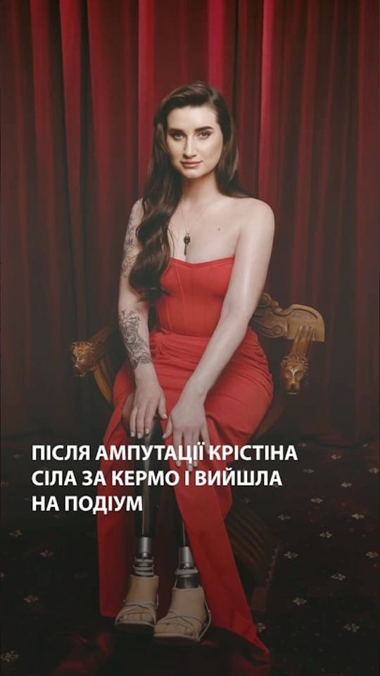Як ветеранка ЗСУ після ампутації почала життя заново