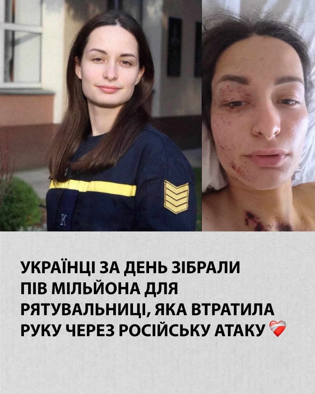 Українці за день зібрали пів мільйона для рятувальниці, яка втратила руку через російську атаку