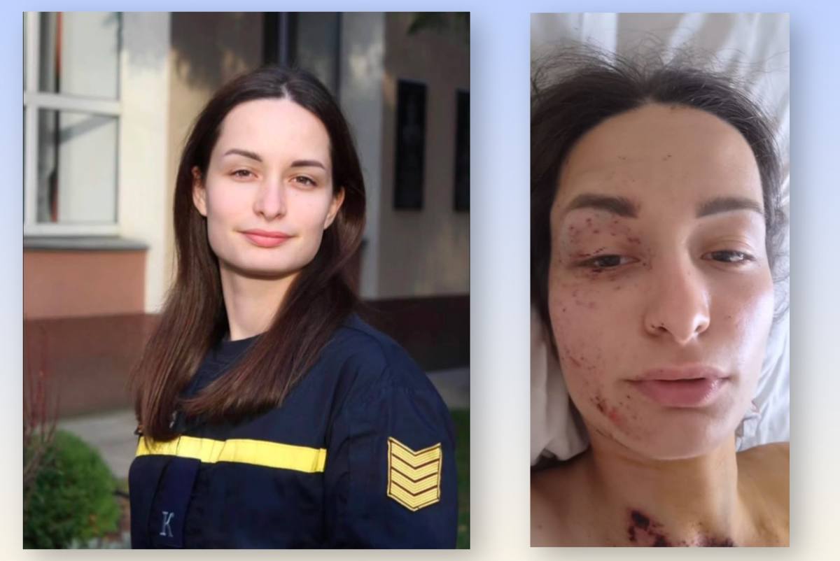 Рятувальниці, яка під повторним обстрілом втратила руку, за добу зібрали понад 600 тис грн