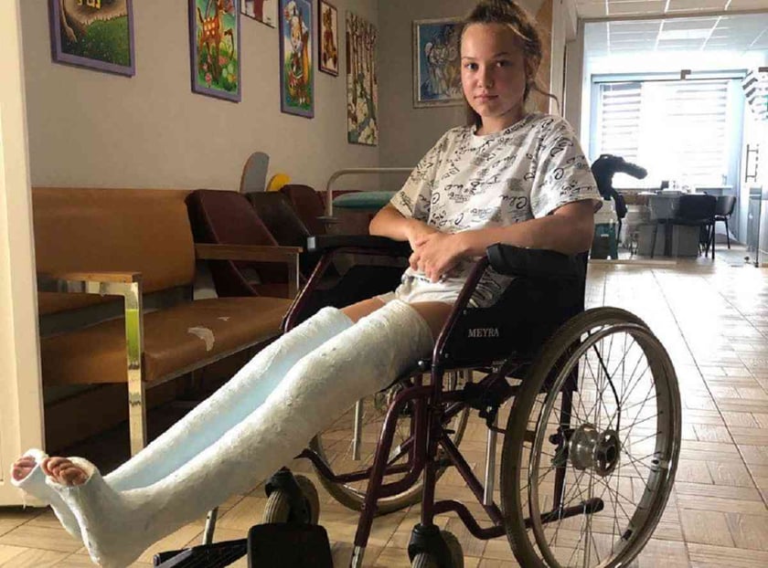 Львівські ортопеди-хірурги повернули 12-річній дівчинці здатність ходити