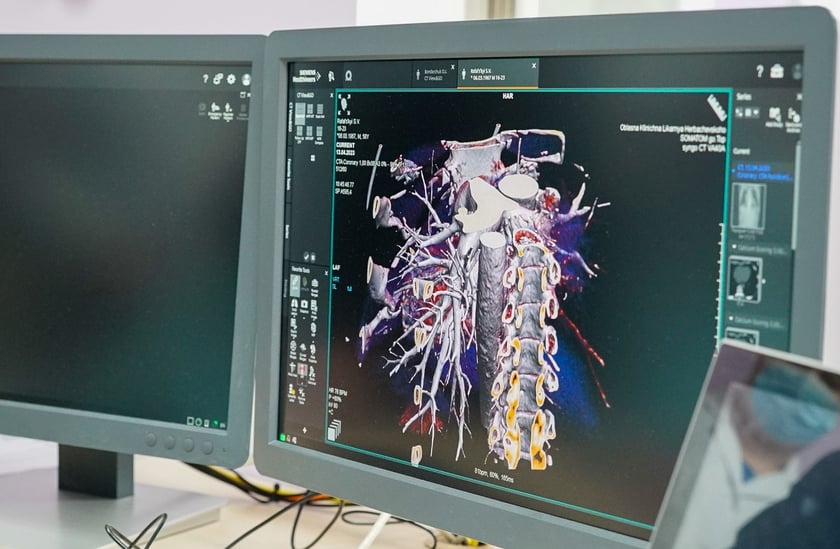 У Житомирській лікарні запрацював надсучасний комп’ютерний томограф