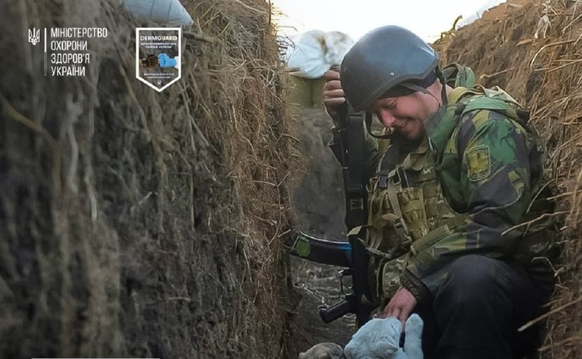 В Україні запустили вебзастосунок для дерматологічної допомоги військовим