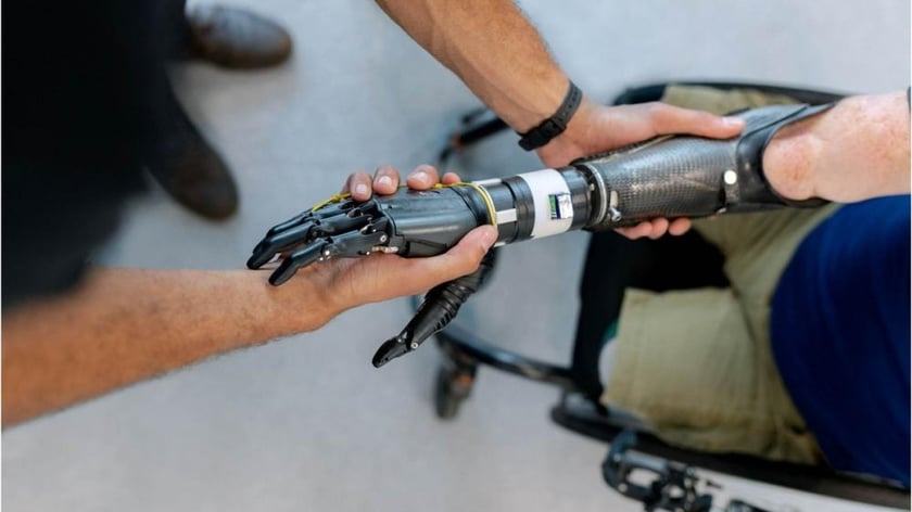 Як в Україні отримати безоплатне протезування