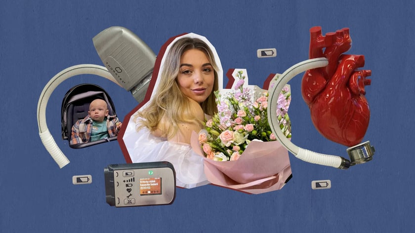 «Коли син виросте, то, можливо, я для нього буду супергероїнею». Історія українки, чиє серце працює від батарейок