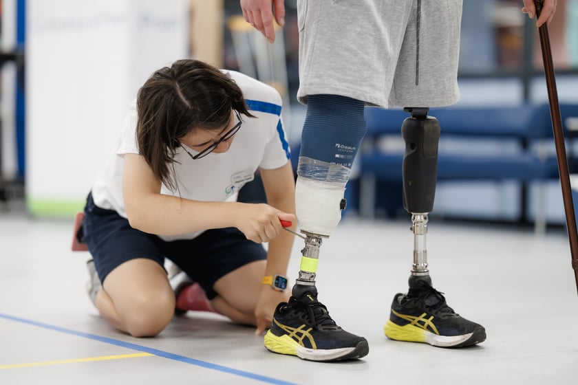 Тисяча українців отримає безплатні протези: хто може подати заявку